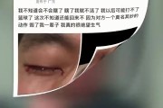 眼科专家谈郭艾伦：结膜受伤经处理大概率恢复得不错 不要太忧心